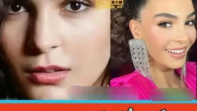 چهره بازیگران مطرح ترکیه ای قبل و بعد از عمل های متعدد